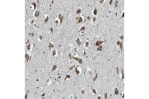 Immunohistochemical staining of human hippocampus with FAM174A polyclonal antibody  shows strong cytoplasmic positivity with a granular pattern in neuronal cells at 1:50-1:200 dilution. (FAM174A Antikörper)