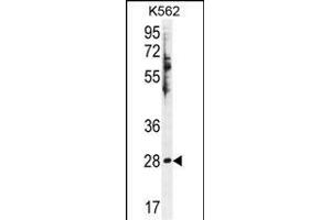 HSD11B1L Antikörper  (C-Term)