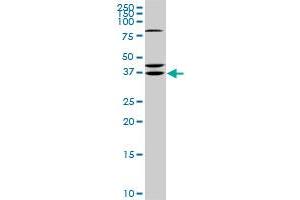 RDHE2 monoclonal antibody (M01), clone 3G8. (SDR16C5 Antikörper  (AA 26-309))