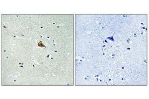 Immunohistochemistry analysis of paraffin-embedded human brain tissue using Trk A (Phospho-Tyr701) antibody. (TRKA Antikörper  (pTyr701))