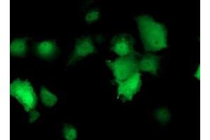 Anti-TMOD1 mouse monoclonal antibody (ABIN2454777) immunofluorescent staining of COS7 cells transiently transfected by pCMV6-ENTRY TMOD1 (RC201134). (Tropomodulin 1 Antikörper)