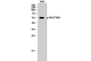 Western Blotting (WB) image for anti-V-Akt Murine Thymoma Viral Oncogene Homolog 1 (AKT1) (pThr308) antibody (ABIN3181908) (AKT1 Antikörper  (pThr308))