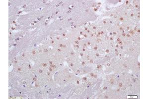 Formalin-fixed and paraffin embedded mouse brain labeled with Anti-CRX1 Polyclonal Antibody, Unconjugated  at 1:200 followed by conjugation to the secondary antibody and DAB staining (CRX Antikörper  (AA 51-150))