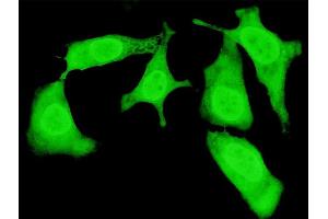 Immunofluorescence of monoclonal antibody to TRIP10 on HeLa cell. (TRIP10 Antikörper  (AA 231-329))
