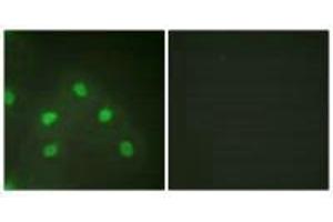 Immunofluorescence analysis of HeLa cells, using hnRNP L antibody. (HNRNPL Antikörper  (N-Term))
