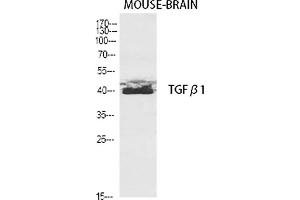 Western Blot analysis of various cells using TGFβ1 Polyclonal Antibody diluted at 1:2000. (TGFB1 Antikörper  (AA 310-390))