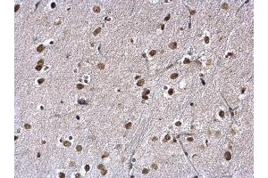 IHC-P Image KAP1 antibody [N1N2], N-term detects KAP1 protein at nucleus on mouse fore brain by immunohistochemical analysis.