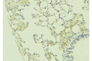 ABIN6269242 at 1/100 staining Human lung tissue by IHC-P. (CASR Antikörper  (C-Term))