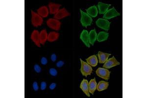 ABIN6260446 and ABIN6276575 staining Hela cells(30 min of UV treatment) by IF/ICC. (CAPNL1 Antikörper  (N-Term))
