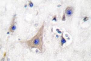 Image no. 2 for anti-Solute Carrier Family 2 (Facilitated Glucose Transporter), Member 3 (SLC2A3) antibody (ABIN265443) (SLC2A3 Antikörper)