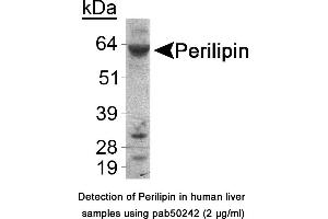 Image no. 1 for anti-Perilipin 1 (PLIN1) (C-Term) antibody (ABIN363551) (PLIN1 Antikörper  (C-Term))