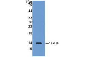Western blot analysis of recombinant Rat LHb. (LHB Antikörper  (AA 21-141))
