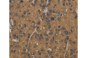 Immunohistochemistry (IHC) image for anti-Hydroxysteroid (17-Beta) Dehydrogenase 2 (HSD17B2) antibody (ABIN2430252) (HSD17B2 Antikörper)