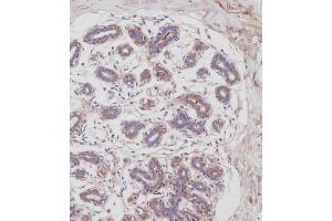 Immunohistochemistry (Paraffin-embedded Sections) (IHC (p)) image for anti-Periostin (POSTN) (AA 687-716), (C-Term) antibody (ABIN655902)