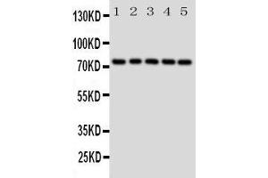 Western Blotting (WB) image for anti-Heat Shock 70kDa Protein 9 (Mortalin) (HSPA9) (AA 591-609), (C-Term) antibody (ABIN3043052) (HSPA9 Antikörper  (C-Term))