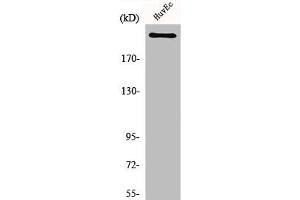 Western Blot analysis of HuvEc cells using Na+ CP-pan Polyclonal Antibody (SCN1A/SCN2A/SCN3A/SCN4A/SCN5A/SCN8A/SCN9A/SCN1A/SCN11A (Internal Region) Antikörper)