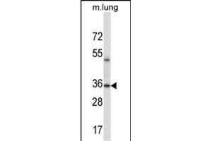 ERCC1 Antibody (C-term) (ABIN658027 and ABIN2846965) western blot analysis in mouse lung tissue lysates (35 μg/lane). (ERCC1 Antikörper  (C-Term))