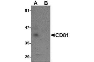 Western blot analysis of CD81 in human lung tissue lysate with AP30217PU-N CD81 antibody at 1 μg/ml in (A) the absence and (B) the presence of blocking petide. (CD81 Antikörper  (N-Term))