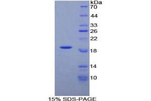 SDS-PAGE analysis of Rat alpha Lactalbumin Protein.