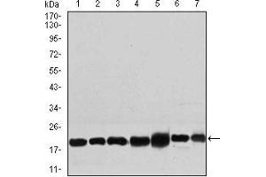 Western blot analysis using RPL18A mouse mAb against NIH3T3 (1), HEK293 (2), HL60 (3), Jurkat (4), Raji (5), MOLT4 (6), and HeLa (7) cell lysate. (RPL18A Antikörper  (AA 50-176))
