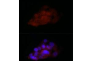 Immunofluorescence analysis of HepG2 cells using TI Rabbit pAb (2523) at dilution of 1:100 (40x lens). (TIA1 Antikörper  (C-Term))