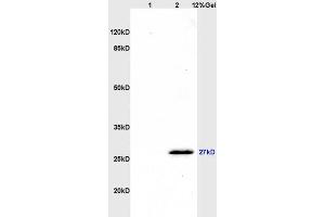 SDS-PAGE (SDS) image for anti-CD160 (CD160) (AA 81-159) antibody (ABIN741555)