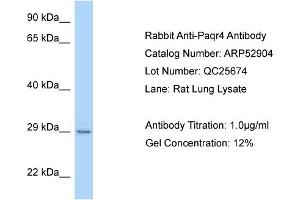 Western Blotting (WB) image for anti-Progestin and AdipoQ Receptor Family Member IV (PAQR4) (C-Term) antibody (ABIN2785146) (PAQR4 Antikörper  (C-Term))