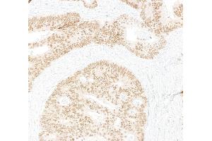 Immunohistochemistry (IHC) image for anti-Caudal Type Homeobox 2 (CDX2) antibody (ABIN7795598)