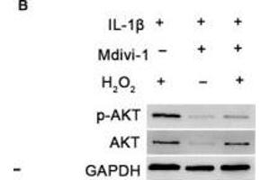 DNM1L deficiency reduces ROS production and autophagy in FLS. (GAPDH Antikörper)