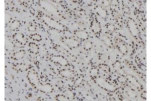 ABIN6262196 and ABIN6278236 at 1/100 staining Human kidney tissue by IHC-P. (HDLBP Antikörper  (N-Term))
