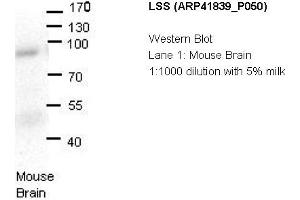 Image no. 1 for anti-Lanosterol Synthase (2,3-Oxidosqualene-Lanosterol Cyclase) (LSS) (N-Term) antibody (ABIN2777020) (LSS Antikörper  (N-Term))