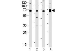 Western Blotting (WB) image for anti-Protein Kinase C and Casein Kinase Substrate in Neurons 2 (PACSIN2) (AA 342-371) antibody (ABIN5647224)