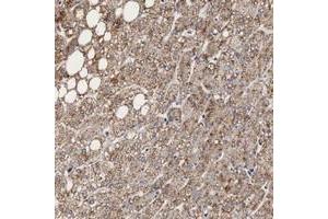 Immunohistochemical staining of human liver with RNASE6 polyclonal antibody  shows moderate cytoplasmic positivity in hepatocytes at 1:20-1:50 dilution.
