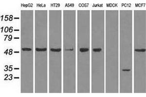 Western blot analysis of extracts (35 µg) from 9 different cell lines by using anti-SLC2A5 monoclonal antibody. (SLC2A5 Antikörper)