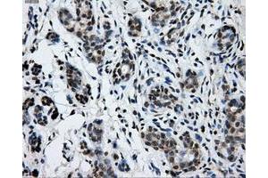 Immunohistochemical staining of paraffin-embedded breast tissue using anti-GRIPAP1 mouse monoclonal antibody. (GRIPAP1 Antikörper)