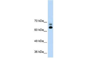 WB Suggested Anti-MTA2 Antibody Titration:  1. (MTA2 Antikörper  (C-Term))
