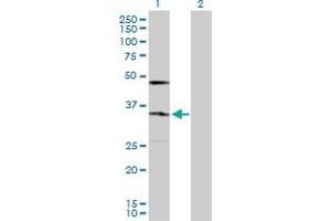 Western Blot analysis of KDELR2 expression in transfected 293T cell line by KDELR2 MaxPab polyclonal antibody. (KDELR2 Antikörper  (AA 1-212))