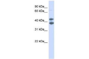 Western Blot showing SOX4 antibody used at a concentration of 1. (SOX4 Antikörper  (N-Term))