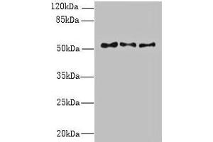 Western blot All lanes: TRIML1 antibody at 3 μg/mL Lane 1: Mouse kidney tissue Lane 2: Human placenta tissue Lane 3: A431 whole cell lysate Secondary Goat polyclonal to rabbit IgG at 1/10000 dilution Predicted band size: 54 kDa Observed band size: 54 kDa (TRIML1 Antikörper  (AA 277-468))