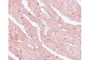 Immunohistochemical staining of mouse heart tissue with MTUS2 polyclonal antibody  at 5 ug/mL dilution. (CAZIP Antikörper  (C-Term))