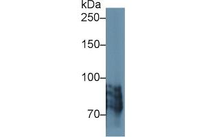Western blot analysis of Human BXPC3 cell lysate, using Human POSTN Antibody (1 µg/ml) and HRP-conjugated Goat Anti-Rabbit antibody ( (Periostin Antikörper  (AA 500-630))