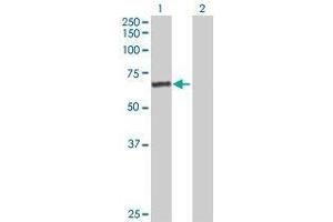 Lane 1: CFHR5 transfected lysate ( 64. (CFHR5 293T Cell Transient Overexpression Lysate(Denatured))