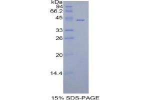 SDS-PAGE analysis of Human HIST1H2AA Protein.