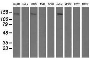 Image no. 2 for anti-Histone Deacetylase 6 (HDAC6) antibody (ABIN1498621) (HDAC6 Antikörper)