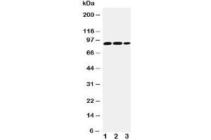 Western blot testing of STAT4 antibody and Lane 1:  rat testis;  2: human U87;  3: (h) HeLa cell lysate (STAT4 Antikörper  (AA 1-17))