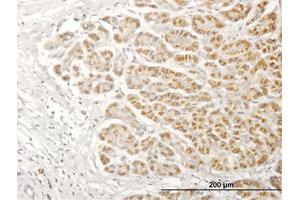 Immunohistochemistry (Formalin-fixed Paraffin-embedded Sections) (IHC (fp)) image for anti-NADH Dehydrogenase (Ubiquinone) 1 alpha Subcomplex, 13 (NDUFA13) (AA 1-144) antibody (ABIN1327603)