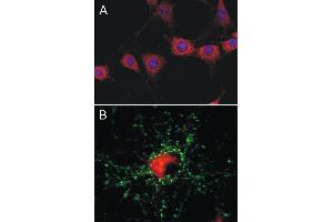 A: Indirect immunolabeling of 3T3 cells (dilution 1 : 500). (CHRNB1 Antikörper)