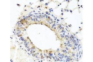 Immunohistochemistry of paraffin-embedded Mouse lung using MUC16 Polyclonal Antibody at dilution of 1:100 (40x lens). (MUC16 Antikörper)