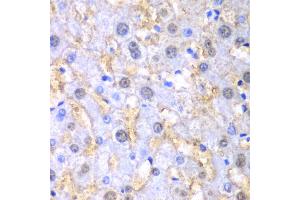 Immunohistochemistry of paraffin-embedded human liver injury using FAH antibody. (FAH Antikörper)