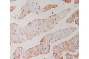 IHC-P analysis of Mouse Skeletal Muscle Tissue, with DAB staining. (PLA2R1 Antikörper  (AA 1418-1487))